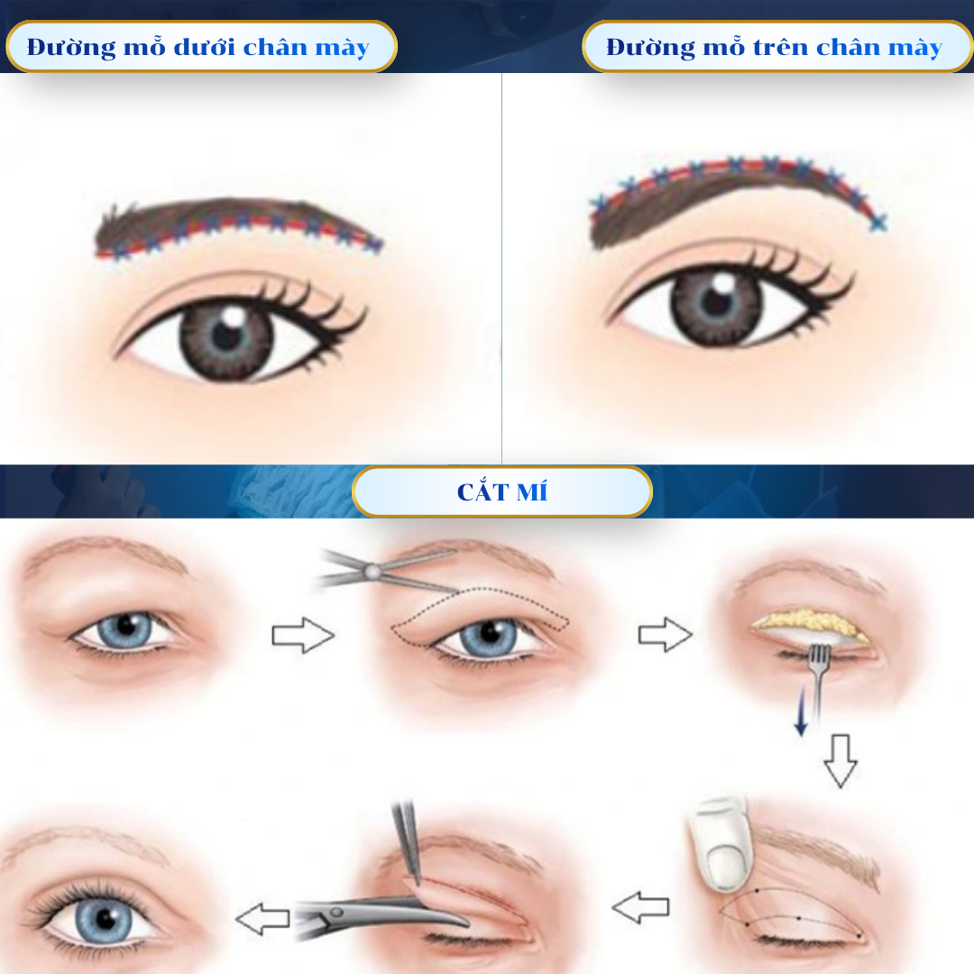 nang_cung_may_cat_mi