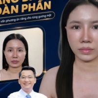 Căng Da Mặt V-Line Tại Dr. Trí: Đột Phá Xóa Sổ Mặt Thịt, Thu Nhỏ Khuôn Mặt To Bè Và Trẻ Hóa Đa Tầng