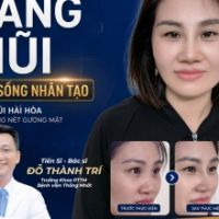 Nâng Mũi Đặt Sống Nhân Tạo Cùng TS.BS Đỗ Thành Trí: Bí Quyết Đẩy Cao Sống Mũi Thanh Tú, Đẹp Tự Nhiên