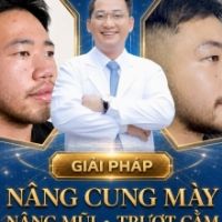  Phẫu Thuật Trượt Cằm Tự Thân – Khắc Phục Cằm Lẹm, Tạo Dáng V-Line Đẹp Trọn Đời Tại TMV Tiến Sĩ Trí