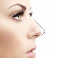 HÚT MỠ NỌNG CẰM: KIẾN TẠO ĐƯỜNG VIỀN HÀM SẮC NÉT – BÍ QUYẾT GÓC NGHIÊM 