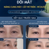 Combo Trẻ Hóa Mắt Toàn Diện Cùng TS.BS Đỗ Thành Trí | Xóa Sạch Dấu Vết Tuổi Tác